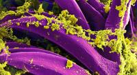 Der Pesterreger Yersinia pestis ist in vielen Teilen Kaliforniens präsent, nun hat sich eine Person beim Camping mit dem Bakterium infiziert.