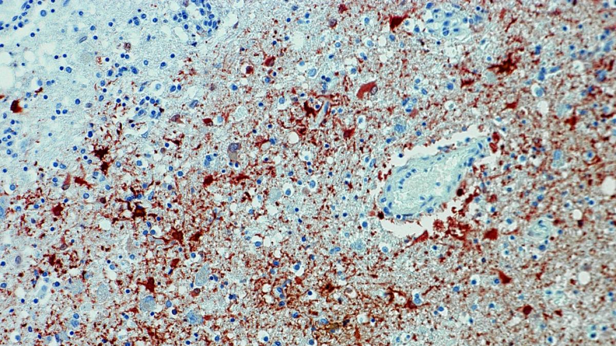 Die undatierte Aufnahme zeigt einen Anitk&ouml;rpernachweis zum Borna-Virus im Gewebe. (Foto)