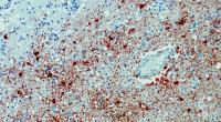 Die undatierte Aufnahme zeigt einen Anitkörpernachweis zum Borna-Virus im Gewebe.