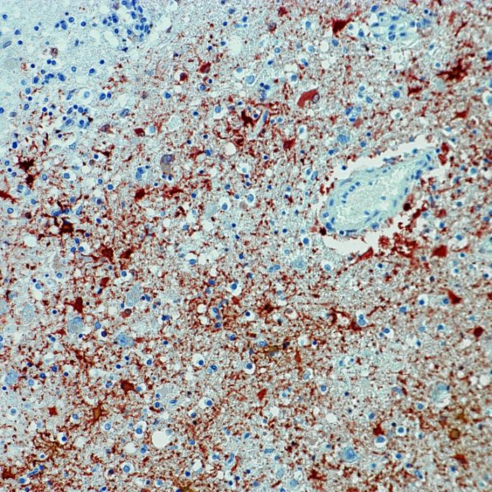 Tödliches Borna-Virus in Bayern nachgewiesen