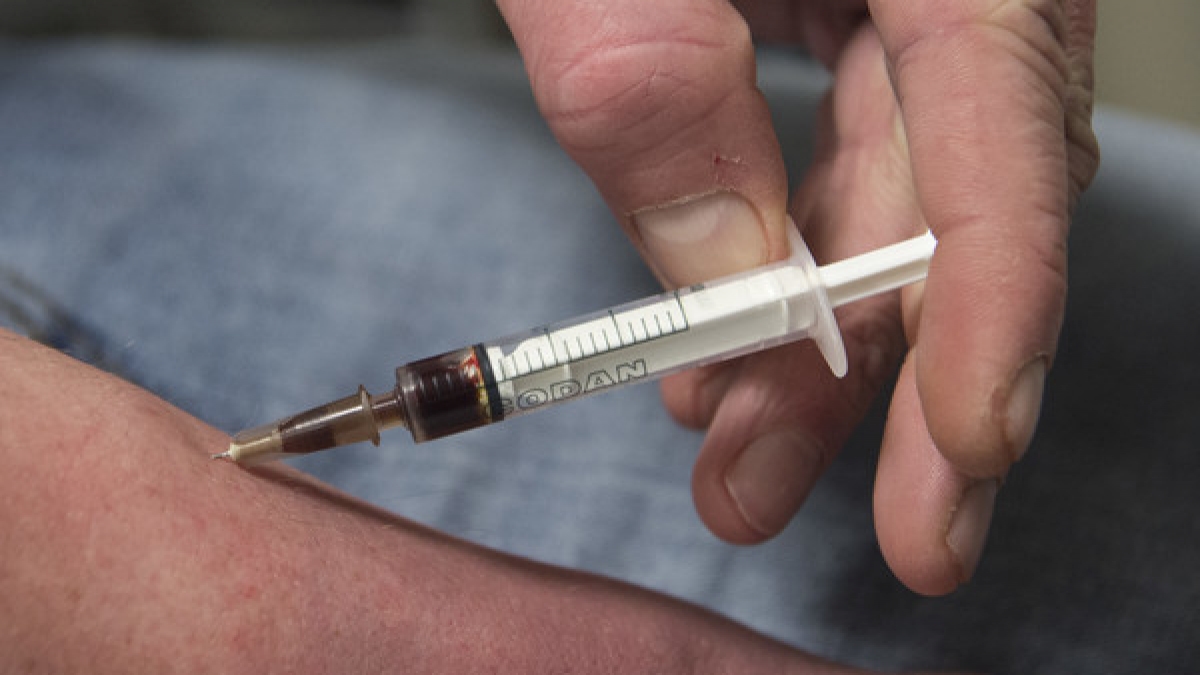 Das Bet&auml;ubungsmittel Caryfentanyl wird immer h&auml;ufiger genutzt, um minderwertiges Heroin zu strecken - doch schon winzige Mengen des Mittels k&ouml;nnen t&ouml;dlich sein. (Foto)