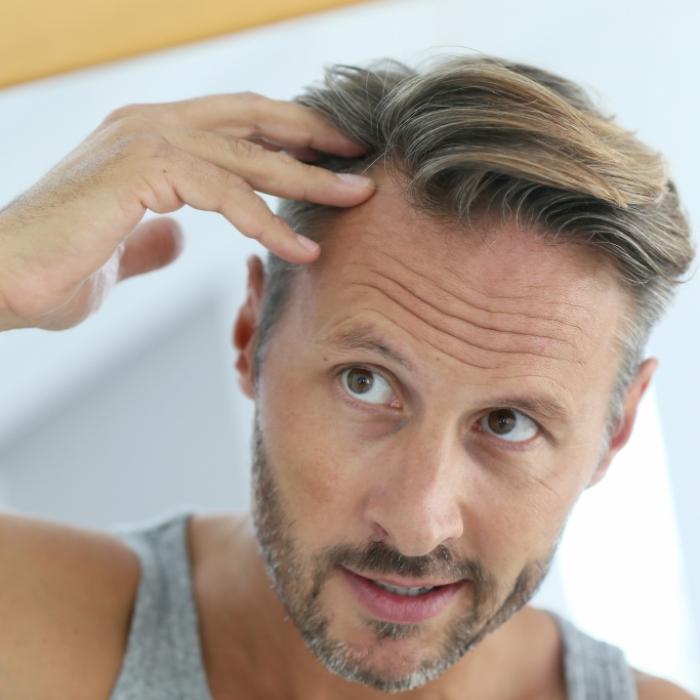 Sorge um Haarausfall? Diese Getränke können für eine Glatze sorgen