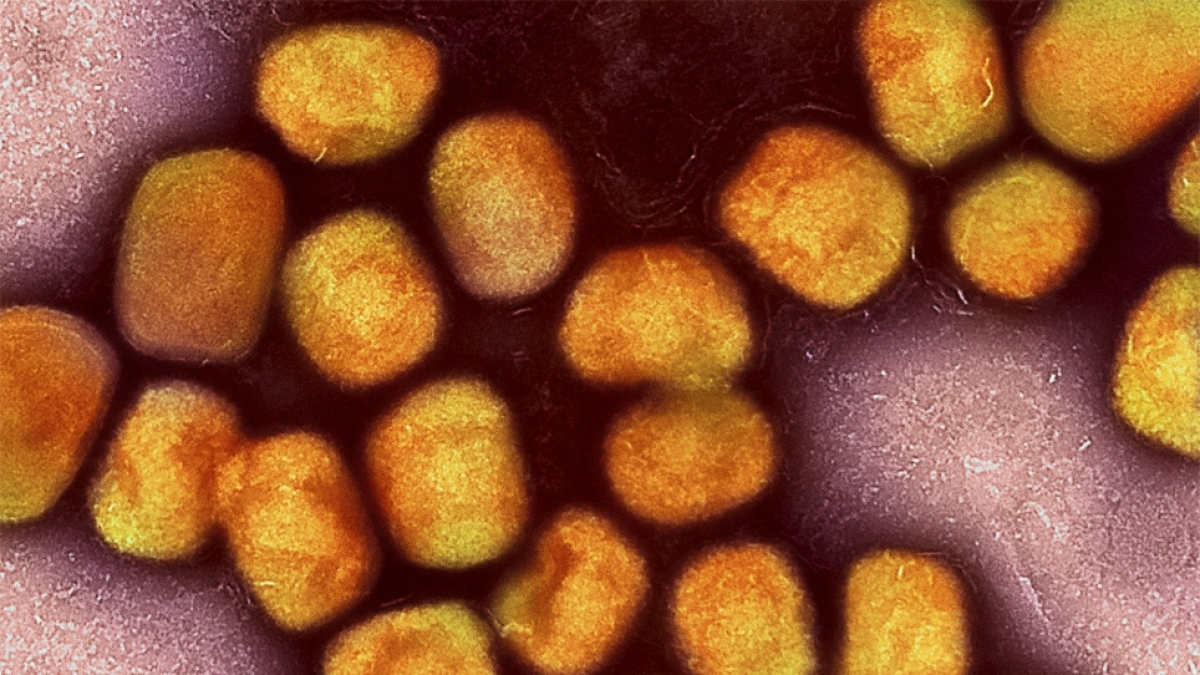 Affenpocken oder auch Mpox, ist eine virale Infektionskrankheit, die durch das Mpox-Virus verursacht wird. Es geh&ouml;rt zur Familie der Pockenviren (Orthopoxviridae). (Foto)