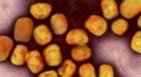 Affenpocken oder auch Mpox, ist eine virale Infektionskrankheit, die durch das Mpox-Virus verursacht wird. Es gehört zur Familie der Pockenviren (Orthopoxviridae).