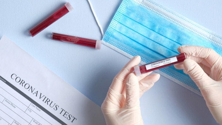 Das Coronavirus breitet sich auch in Deutschland immer weiter aus.