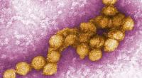 Eine Aufnahme des West-Nil-Virus unter dem Elektronenmikroskop.