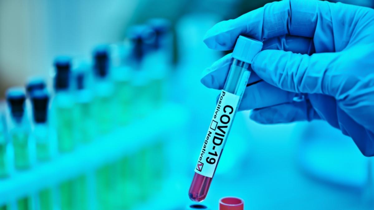 Wurde Sars-CoV-2 im Labor entwickelt? (Foto)