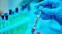 Wurde Sars-CoV-2 im Labor entwickelt?