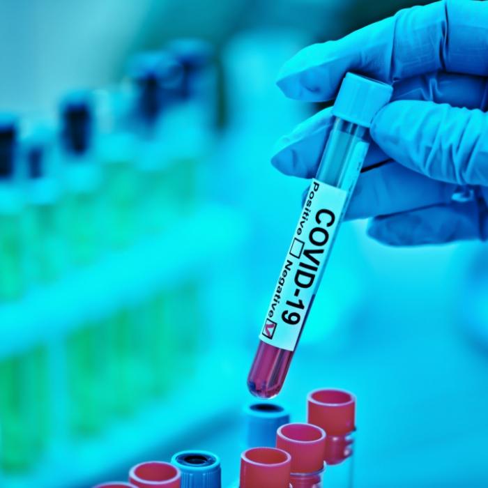 Corona-Ursprung eindeutig! Sars-CoV-2 sollte schon 2018 entwickelt werden
