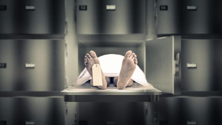 Woran sterben Covid-19-Patienten wirklich? Obduktionen geben Antworten.
