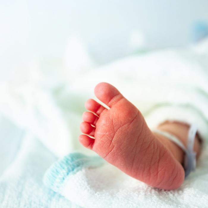 Baby mit Schweineschnauze und Ohren am Hals geboren