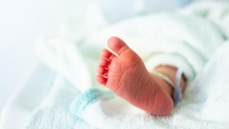 In Aserbaidschan wurde ein Baby mit extremen Fehlbildungen geboren.