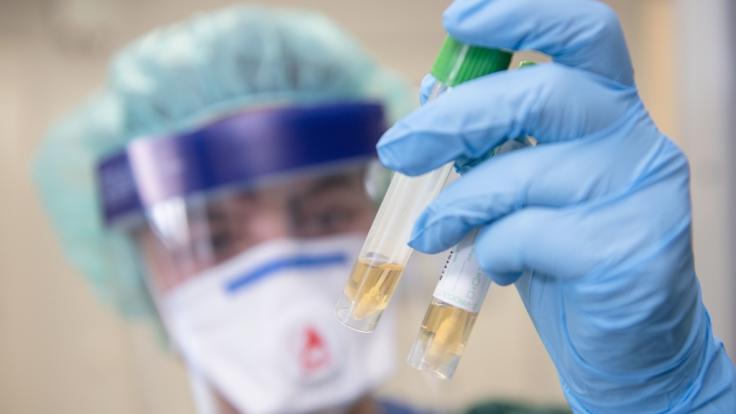 In Nordrhein-Westfalen ist erstmals ein Patient nachweislich an dem neuartigen Coronavirus erkrankt - und in intensivmedizinischer Behandlung.