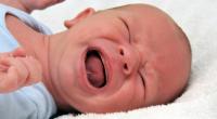 In Texas wurde ein Baby ohne Haut geboren.