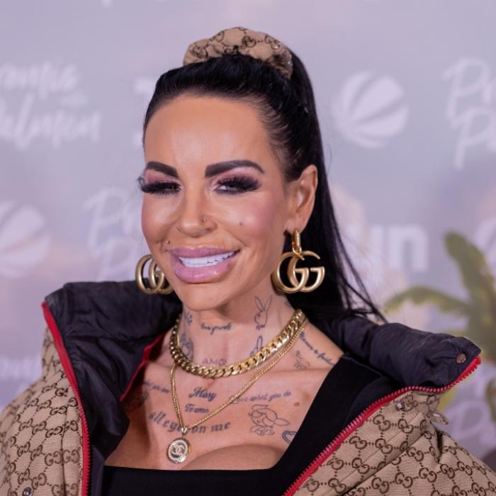 Reality-Star gönnt sich beim Beauty-Doc neues Gesicht für 6.000 Euro