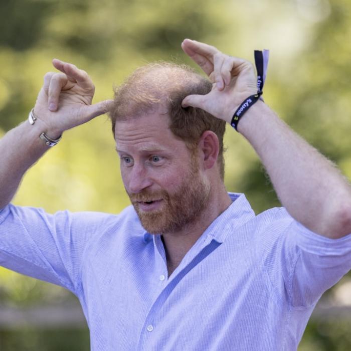 Haariges Problem des Sussex-Herzogs wirft erneut Fragen auf
