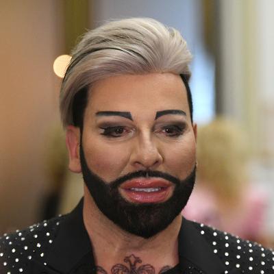 8 Kilo abgenommen! SO sieht er dank OPs und Botox nicht mehr aus