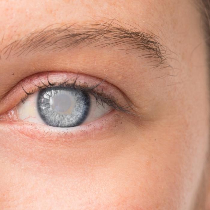 Influencerin erblindet nach Augen-Tattoo