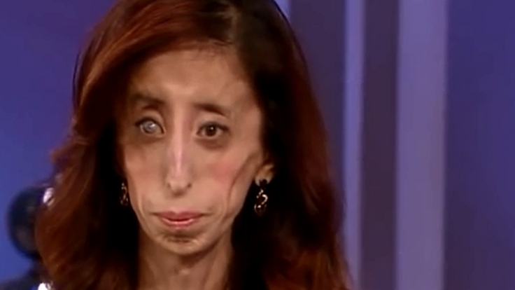 Texanerin Lizzie Velasquez hat null Prozent Körperfett.