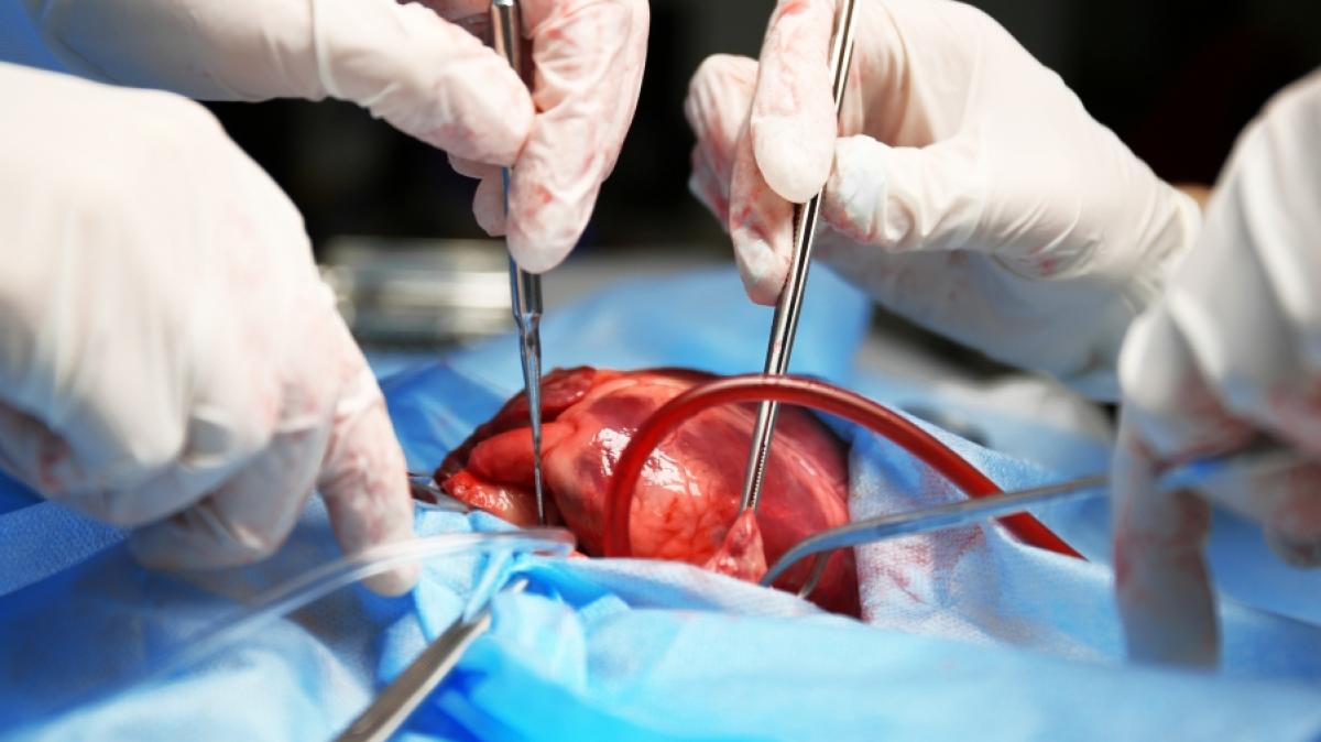 In den USA wurde einem Mann eine Herztransplantation verwehrt, weil er keine Corona-Impfung hat. (Foto)