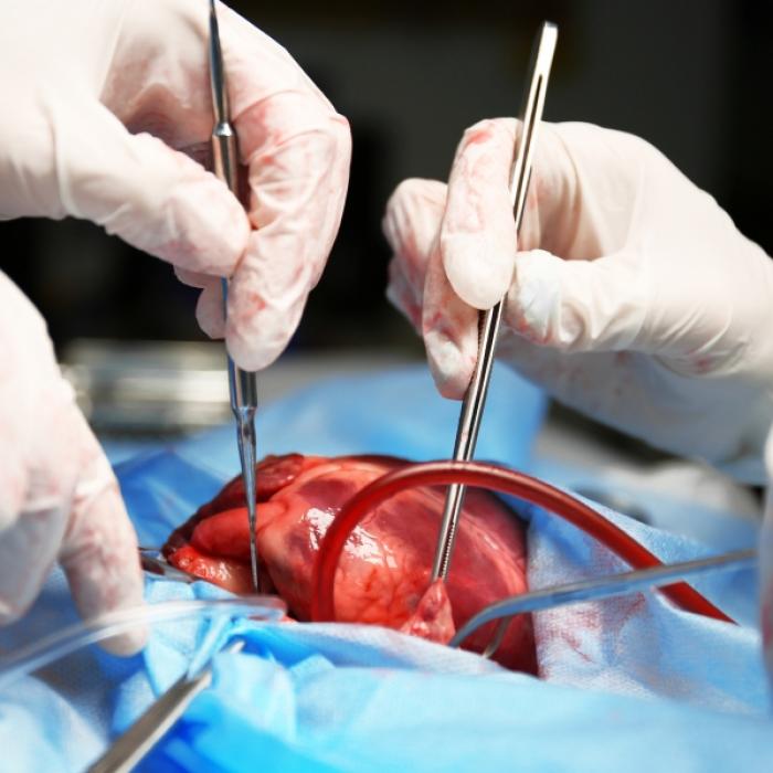Keine Corona-Impfung! Krankenhaus lehnt Todkranken für Herztransplantation ab