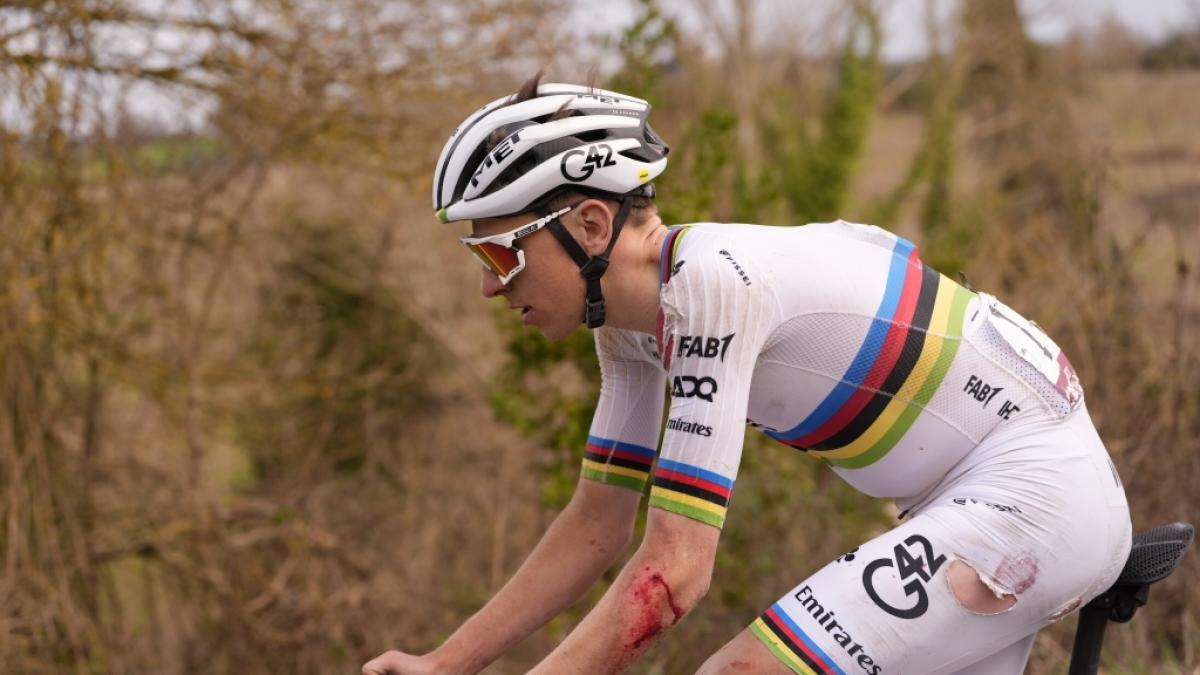 Tadej Pogacar ist nach seinem Sturz beim Strade Bianche gezeichnet. Er konnte das Eintagesrennen trotzdem gewinnen. (Foto)