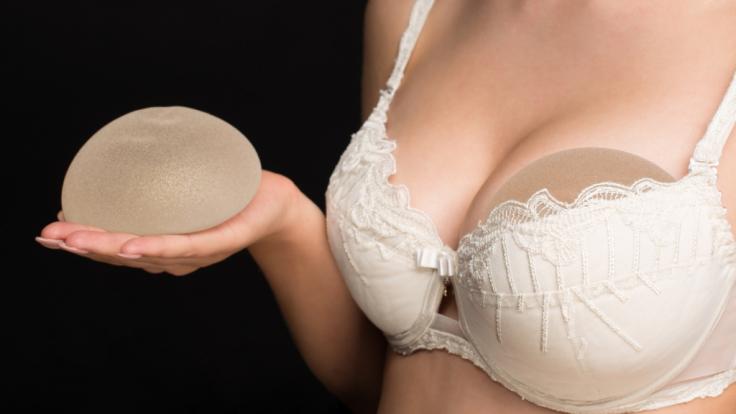 Ein Produktrückruf von Silikonimplantaten der Firma Allergan im Sommer 2019 ließ viele Frauen verunsichert zurück.
