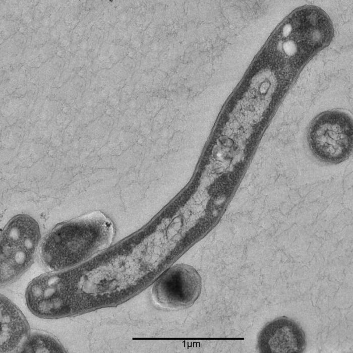 Experten warnen - Infektionen könnten zunehmen