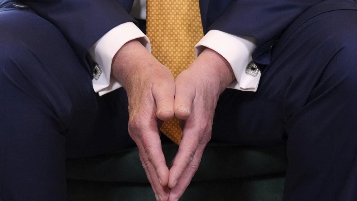 Make-up-Flecken l&uuml;gen nicht: W&auml;hrend eines Pressetermins waren notd&uuml;rftig kaschierte Blessuren auf Donald Trumps rechtem Handr&uuml;cken unschwer zu erkennen. (Foto)