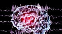Epilepsien zählen zu den neurologischen Erkrankungen.
