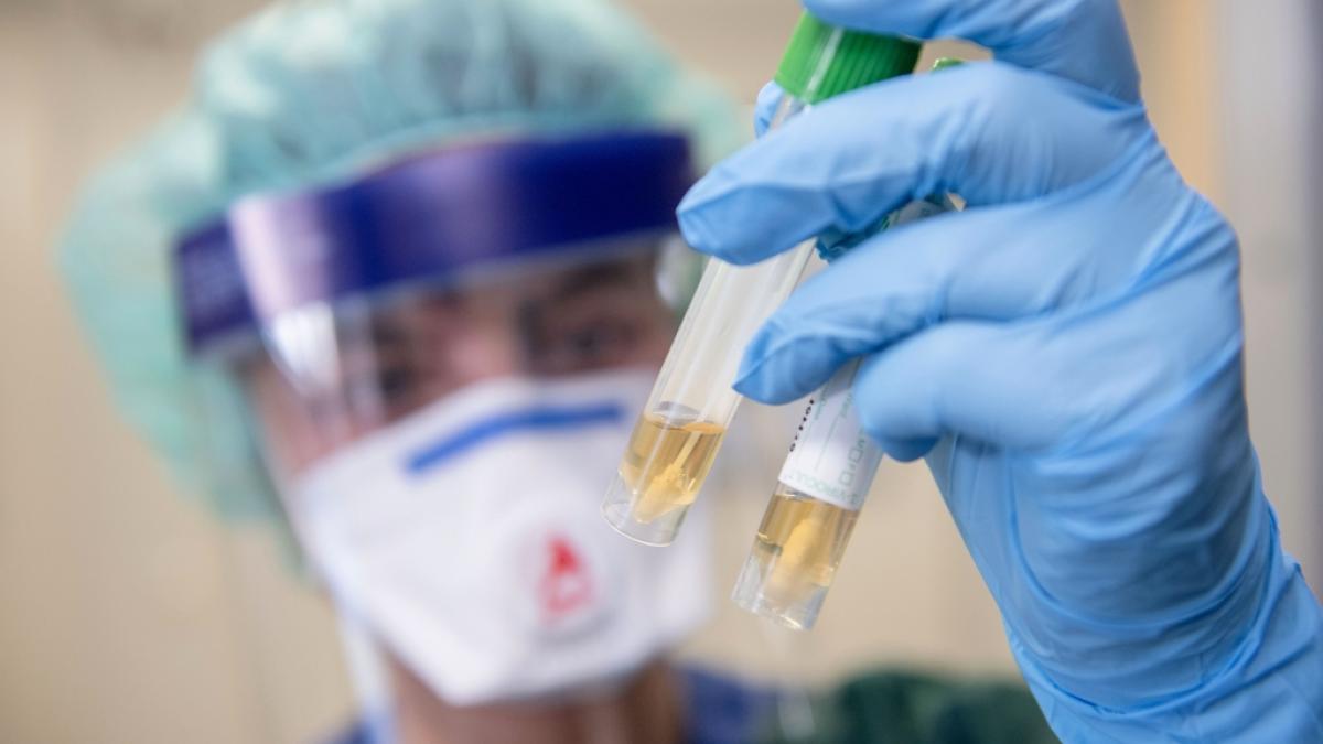 Das neuartige Coronavirus h&auml;lt mittlerweile die ganze Welt in Atem. (Foto)