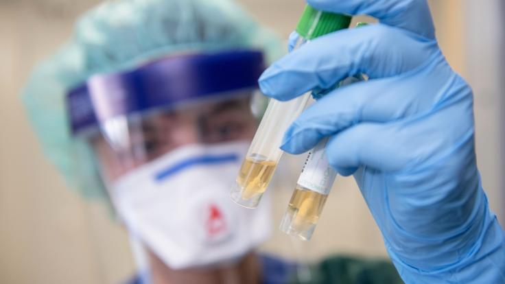 Das neuartige Coronavirus hält mittlerweile die ganze Welt in Atem.