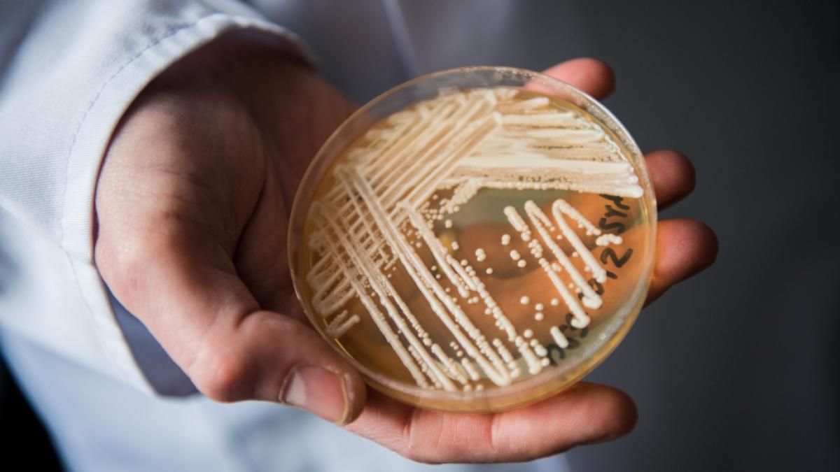 Auch in Deutschland werden immer mehr F&auml;lle bekannt, in denen schwer kranke Patienten mit dem gef&auml;hrlichen Hefepilz Candida auris infiziert sind. (Foto)