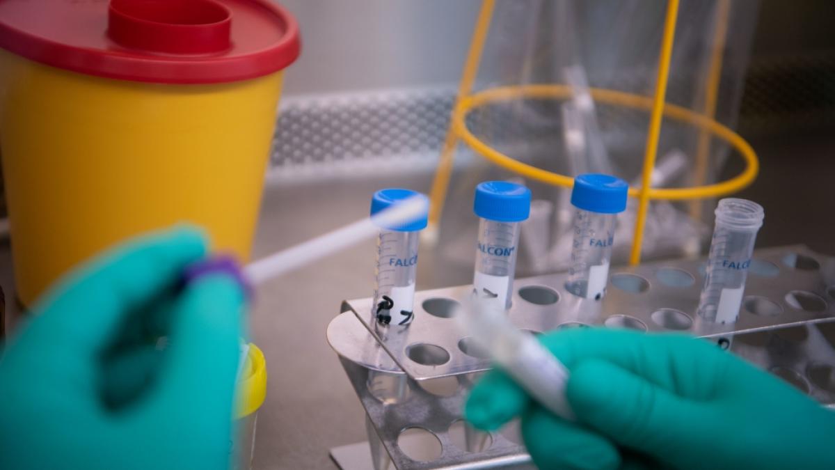 Was passiert bei einer Coronavirus-Pandemie in Deutschland? (Foto)