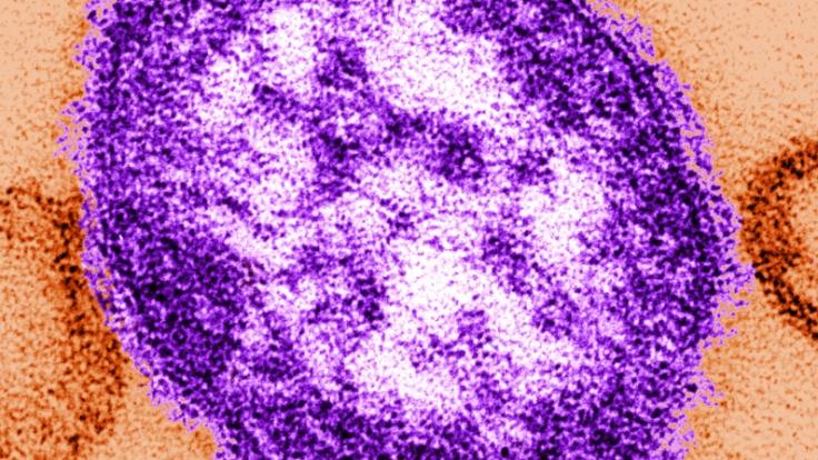 Der Masernvirus unter dem Mikroskop.