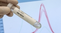Wissenschaftler warnen vor der Gefahr einer Doppel-Varianten-Infektion.