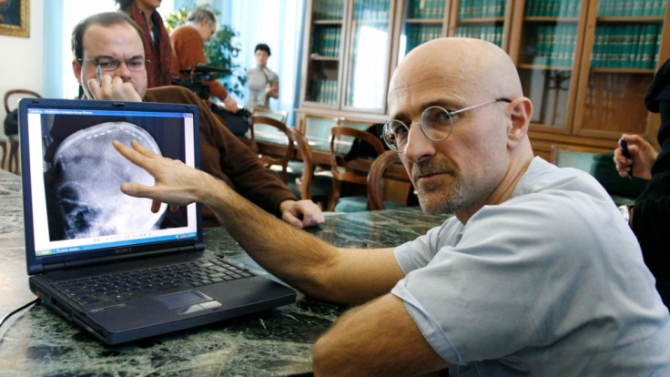 Der Chirurg Sergio Canavero möchte den Kopf eines Menschen transplantieren.