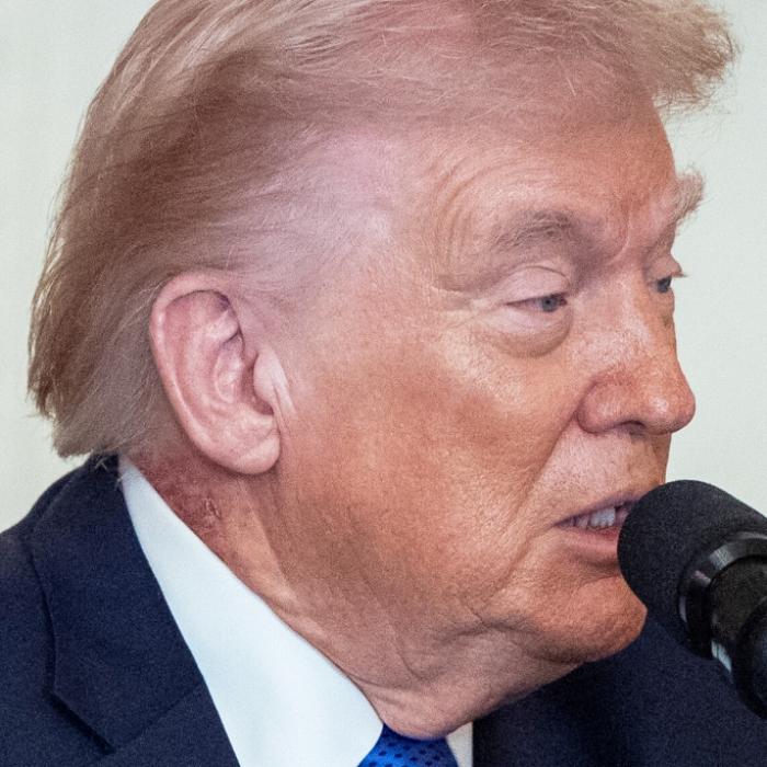 Neues Symptom sticht direkt ins Auge - Trumps Arzt zu Statement gezwungen
