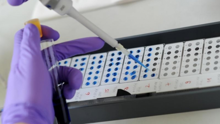 Der Hantavirus breitet sich aus: Experten prognostizieren für 2017 mehr als 2440 Infektionsfälle.