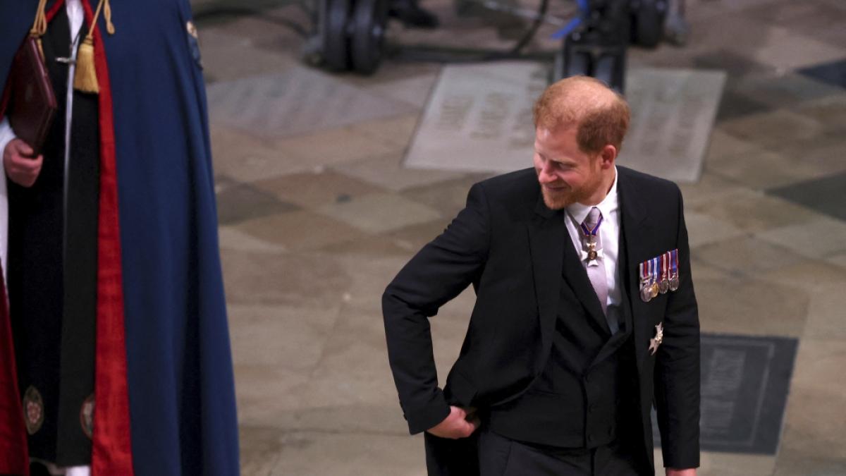 Prinz Harry hat kaum noch Haare auf dem Kopf. (Foto)
