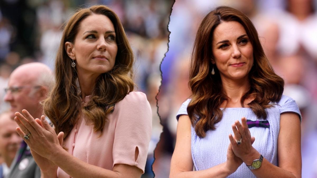 Hat sich Herzogin Kate unters Messer gelegt? (Foto)