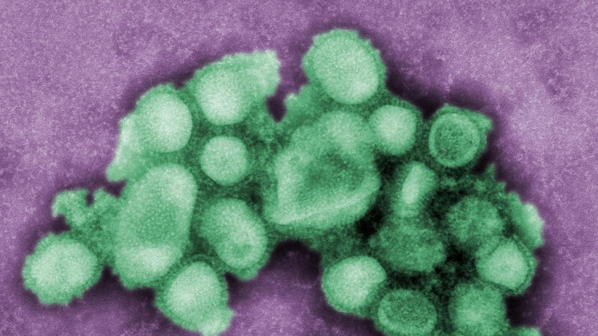 In Gro&szlig;britannien hat sich eine Person mit der Schweinegrippe-Variante H1N2 infiziert. (Symbolfoto) (Foto)