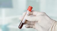Die Farbe von Blut verrät einiges über die Gesundheit.