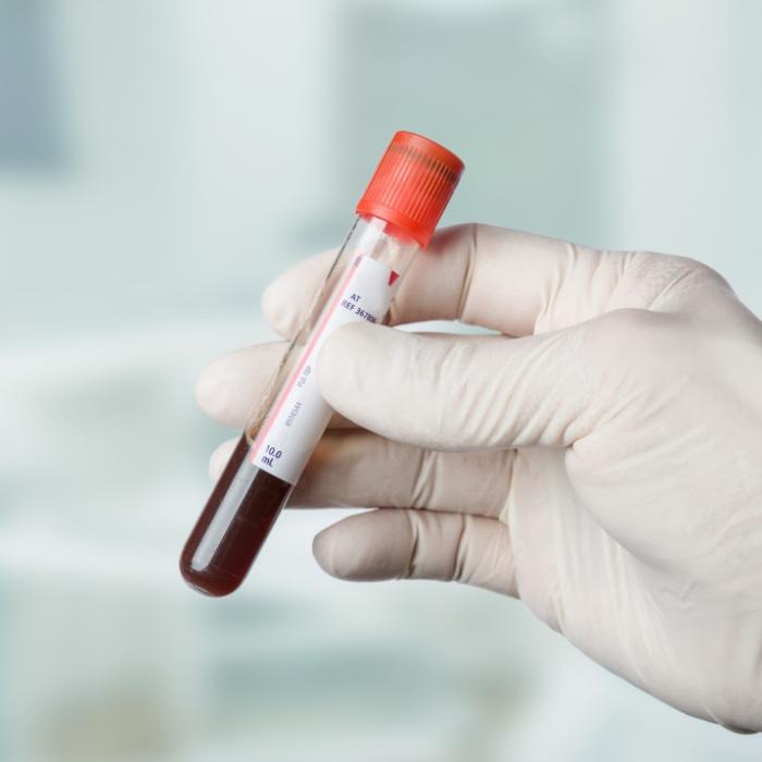 Was die Farbe von Blut über unsere Gesundheit verrät