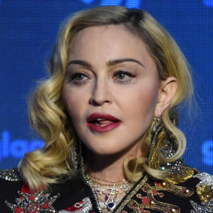 Blaue Flecken überall! Wer hat Madonna nur SO zugerichtet?