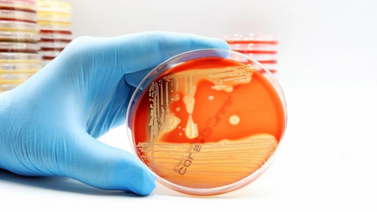 Eine kerngesunde 29-J&auml;hrige aus Australien bezahlte eine Infektion mit dem multiresistenten Keim MRSA mit dem Leben (Symbolfoto). (Foto)
