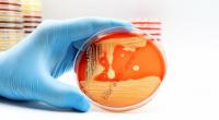 Eine kerngesunde 29-Jährige aus Australien bezahlte eine Infektion mit dem multiresistenten Keim MRSA mit dem Leben (Symbolfoto).