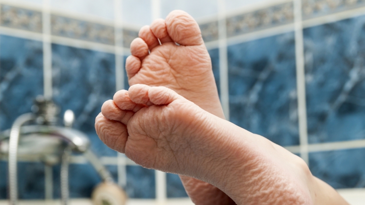 Warum schrumpelt die Haut, wenn man badet? (Foto)