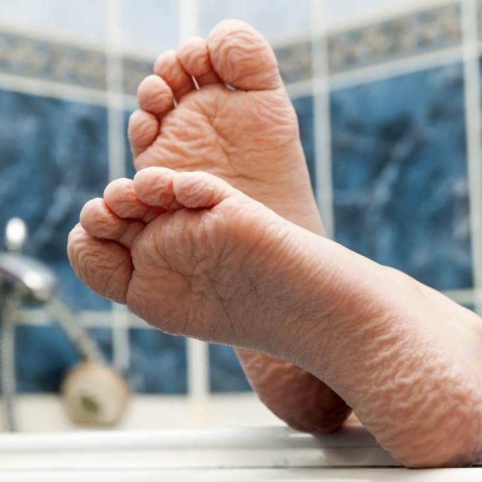Warum schrumpeln die Finger beim langen Baden?