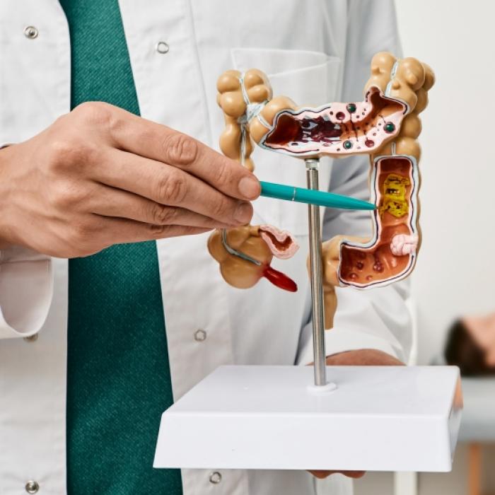 Darmkrebs-Patienten plötzlich geheilt durch 